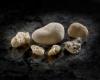 Photo for Kidney Stones Market - Global Forecast To 2022