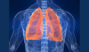 Photo for Respiratory Diagnostics Market Forecasted Double-Digit Growth Rate Through 2024