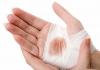 Photo for Wound Care Market: Upcoming Demands and Growth Analysis 2024