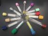 Photo for Phlebotomy Tubes Market – Global Industry Insights, Trends, and Opportunity Analysis, 2016–2024
