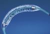 Photo for Global Nitinol Medical Devices Market Research Report 2017
