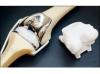 Photo for Global Biomaterials for Musculoskeletal Market Professional Survey Report 2017