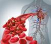 Photo for Venous Thromboembolism (VTE) Market – Global Industry Insights, and Opportunity Analysis, 2016–2024