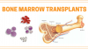Photo for Bone Marrow Transplant Market – Global Industry Insights, Trends