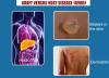 Photo for Graft Versus Host Disease (GVHD) Market - Global Industry Insight, Trends, Size, and Analysis, 2016-2024