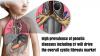 Photo for Cystic Fibrosis Market - Global Industry Insights, Trends, Size, Share and Analysis, 2016 - 2024