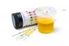 Photo for Urinalysis Market - Industry Analysis, Size, Share, Growth, Trends and Forecast to 2024