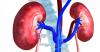 Photo for Hyperphosphatemia In Chronic Kidney Disease - Pipeline Review, H1 2017
