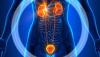 Photo for Bladder Cancer Therapeutics Market – Global Industry Insights, Trends, Outlook, and Opportunity Analysis, 2016–2024