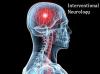Photo for The global Interventional neurology market is expected to expand at a CAGR of 5.3% till 2024
