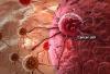Photo for Oncologist in Noida, Top Oncology Doctors | Credihealth