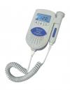 Photo for Global Foetal Heart Monitor Market Research Report 2017
