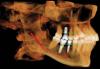 Photo for Dental Imaging Market – Global Industry Insights, Trends, 2017–2025