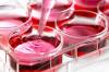 Photo for Cell Culture Market, By Product Type, Application, End User, and Geography - Trends, Analysis and Forecast till 2024