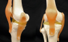 Photo for Best Knee Replacement Surgeon in Delhi