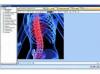 Photo for Global Chiropractic Software Market Research 2017 - Industry Analysis, Demand, Trends, Growth and Forecast 2022