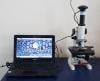 Photo for Global Microscopy Imaging System Market - Opportunities Sales, Revenue, Outlook and Forecast To 2017