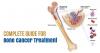 Photo for Bone Cancer Treatment Market - Global Industry Insights, Trends, Outlook, and Opportunity Analysis, 2016–2024