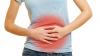 Photo for Irritable Bowel Syndrome Treatment Market - Global Industry Insights, Trends, Outlook, and Analysis, 2017–2025