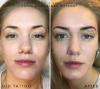 Photo for Convert Your Dream into Reality with Permanent Make Up