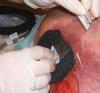 Photo for Negative Pressure Wound Therapy Market worth 4 Billion USD by 2025