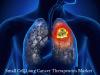 Photo for Small Cell Lung Cancer Therapeutics Market - Global Industry Insights, Trends and Analysis, 2017–2025