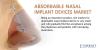Photo for Absorbable Nasal Implant Devices Market -Trends,2024