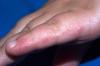 Photo for 2017 Hand, Foot and Mouth Disease Industry Survey, Market Size, Competitive Trends and Forecasts : Orbis Research