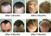 Photo for Regrow Hair Protocol Reviews
