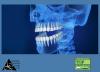 Photo for Celebrating Being Amalgam Free!!!
