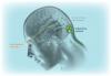 Photo for Wireless Visual Cortical Stimulator Market - Trends, 2024