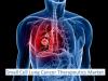 Photo for Small Cell Lung Cancer Therapeutics Market on the basis of diagnosis, types, treatment, drug therapy, and end user - Global Industry Insights, 2025
