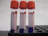 Photo for Phlebotomy Tubes Market – Trends 2024