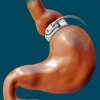 Photo for Gastrointestinal Devices Market – Trends 2024
