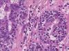 Photo for Digital Pathology Market – Trends, 2025