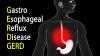 Photo for Gastroesophageal Reflux Disease Treatment Devices Market – Trends, 2025