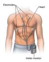 Photo for Holter Monitor Market Global Industry Insights, Opportunity Analysis, and Industry Forecast till 2025