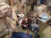 Photo for Extracorporeal Membrane Oxygenation System Market Production, Trends, Price, Revenue and Forecast by 2025