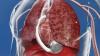 Photo for Cardiac Assist Devices Market - Global Industry Insights, Trends, Outlook, and Analysis, 2016–2024