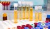 Photo for Urinalysis Market Analysis, Share, Growth and Forecast to 2023