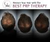 Photo for Sareen Hair & Skin Clinic