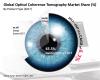 Photo for Optical Coherence Tomography Market to Display a Positive Growth of US$ 1,349.1 Mn by 2027