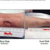 Photo for Physician Wound Care