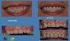 Photo for Gum Disease,Mercury free dentist, amalgam free dentist, SMART protocol, RI top dentist