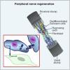 Photo for Global Peripheral Nerve Repair Market Sales Price Analysis Report 2017: Radiant Insights, Inc