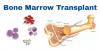 Photo for Bone Marrow Transplant Market – Global Industry Insights, Trends, Outlook, and Analysis, 2016–2024