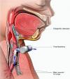 Photo for Global Tracheostomy Market Top Players Report 2022 By Radiant Insights, Inc