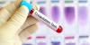 Photo for Acquired Hemophilia Treatment Market 2017 - Survey, Trends, Price, Revenue and Forecast Until 2025