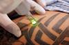 Photo for Tattoo Removal Pros Colorado Springs