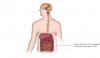 Photo for Opioid Induced Side Effects Treatment Market – Global Industry Insights, Trends, Outlook, and Analysis, 2017–2025
